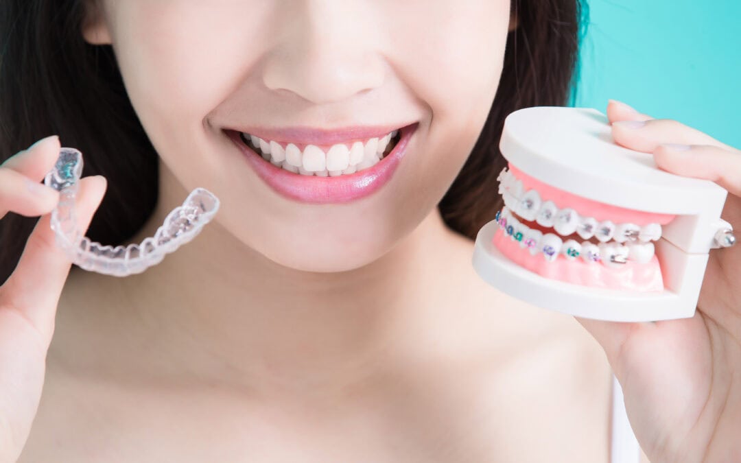 Invisalign or Braces